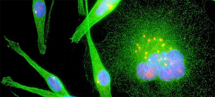 Header image with fluorescence microscopy image showing cells with supernumerary centrosomes