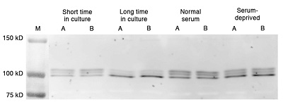 NZM3 pRB expression