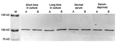 NZM7 pRB expression